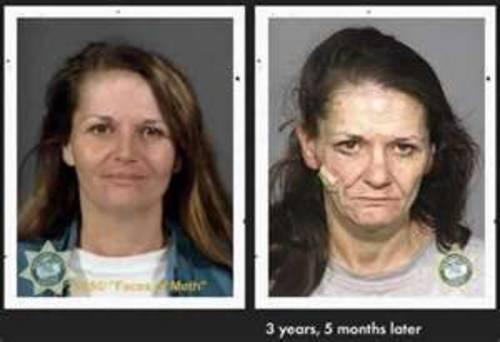 meth before and after example
